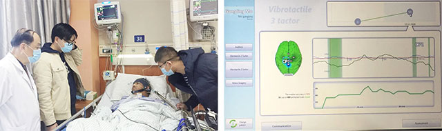 特邀博士为小莫进行脑机接口检测,其神志已经恢复到一半还需继续治疗