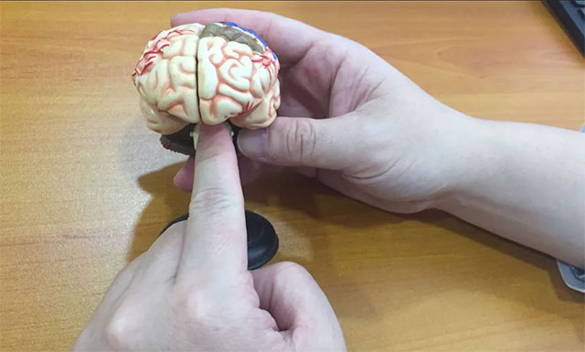 专家详细为患者介绍,眉弓眶上锁孔入路手术方法